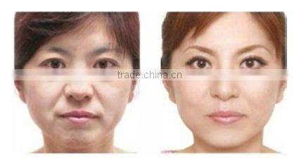 fractional RF beauty equipment for skin lifting wrinkle removal