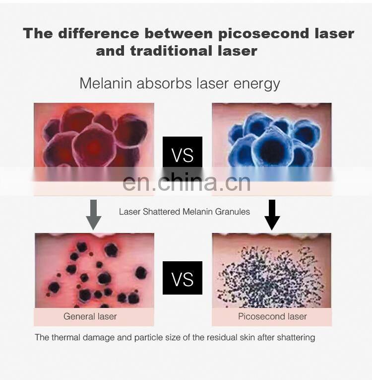 755nm honeycomb nozzle eyeline tattoo pigment removal pico laser machine