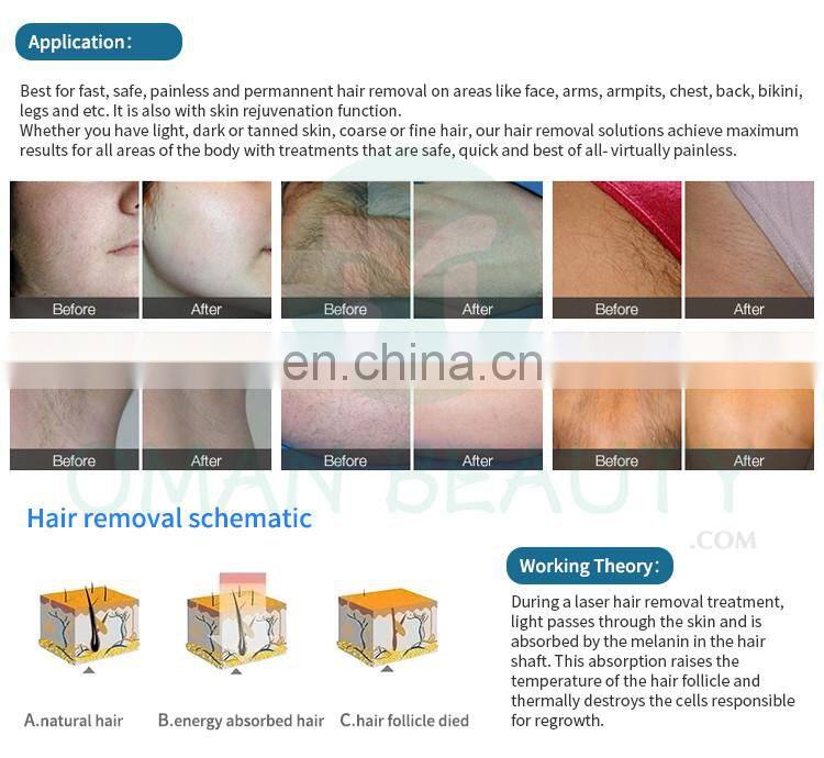 Home Use Portable Hair Removal Laser Epilator IPL Hair Remover machine