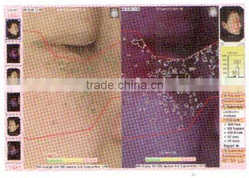 Skin Scanner Analyzer Magnifier Test Machine