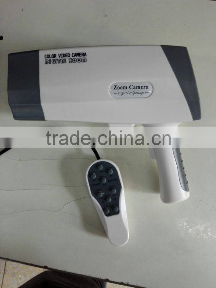 Digital Video Colposcope, Laptop Video Colposcope, Gynecology Video Colposcope