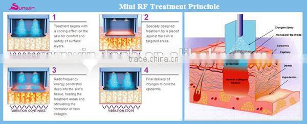 Newest Mini rf facelift machine SW-202B