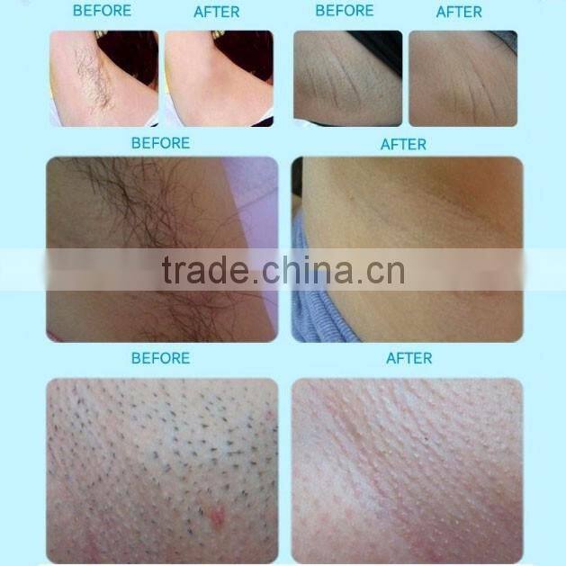 Modern Beauty Equipment!! OPT SHR IPL Machine Hair Removal Laser with Teaching Video