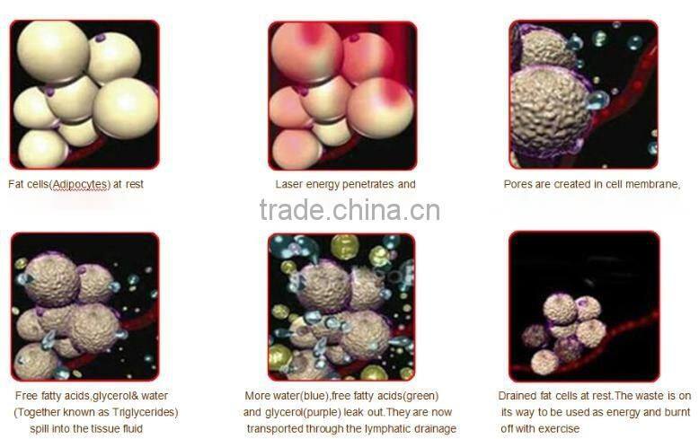 Hot sale home use mini Cryo antifreeze pad cryolipolysis body slimming machine