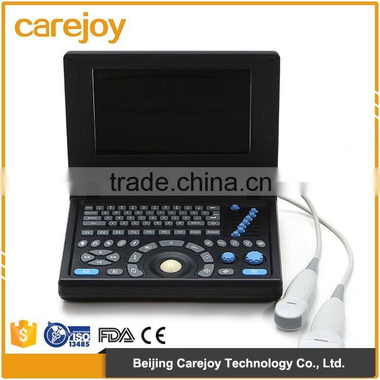 High Quality Ultrasound Machine Medical equipment ultrasound machine portable