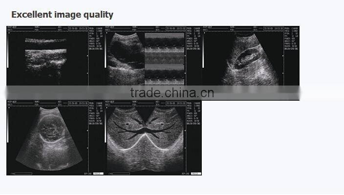 2017 newest B/W Ultrasound Imaging System 3.5Mhz convex probe laptop ultrasound scanner