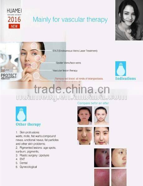 clinic use EVLT laser equipment vascular removal machine 980nm medical diode laser/laser diode 980nm