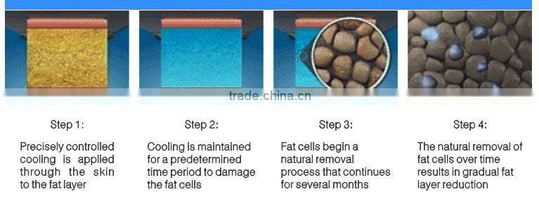 Portable kryolipolyse with two heads weight loss beauty machine