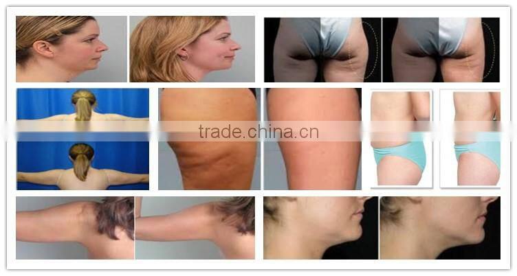 home body beauty vacuum suction machine