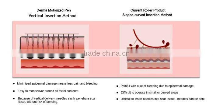 Electric derma pen needles screw 12 pin gold cartridge for auto microneedle derma pen tattoo needles 12pin needle tip