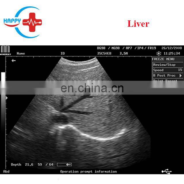 Original Mindray DP-2200PLUS mindray portable ultrasound machine system with competitive price