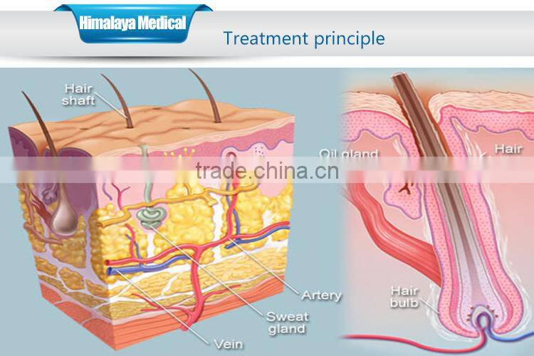 Medical CE approve SHR IPL hair removal permanent/SHR elight ipl hair removal machine