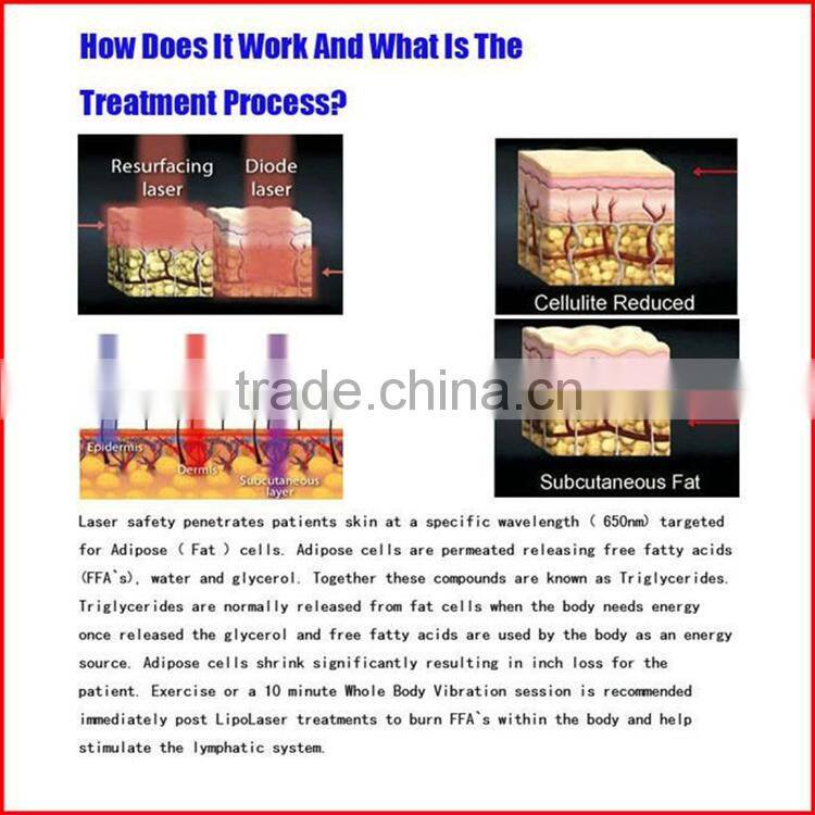 best 650nm lipo laser fat burning laser beauty machine