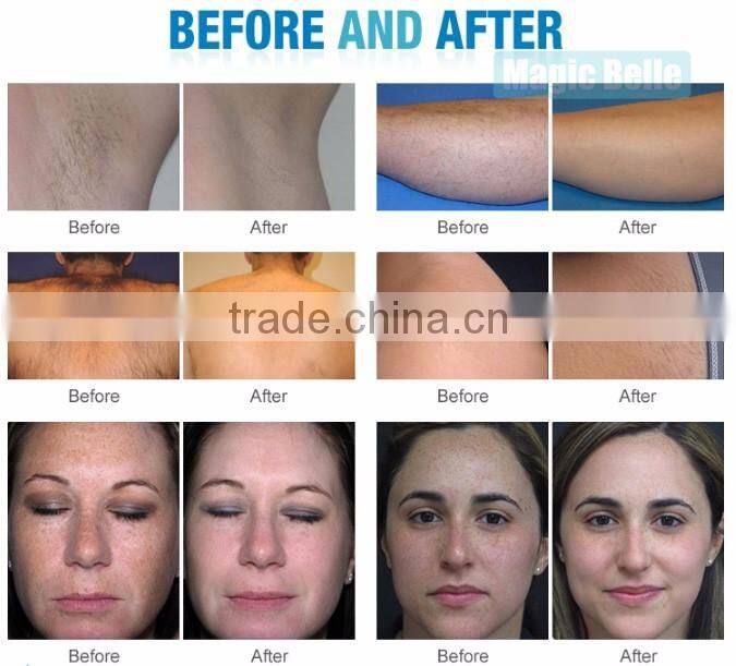 IPL SHR Machine/ Hair Removal Machine/IPL Skin Rejuvenation Machine