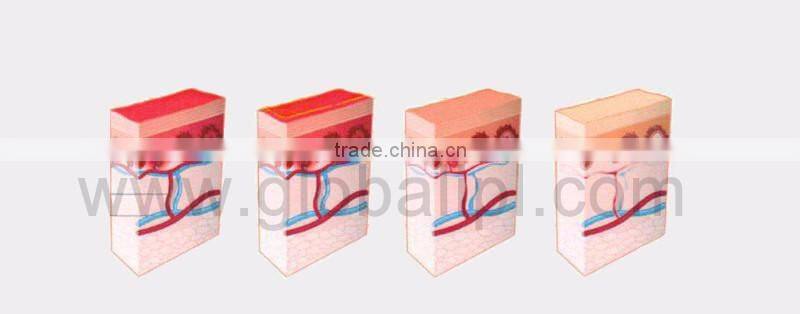 Diode laser vascular removal machine!!! Age spots vascular lesions portable vascular doppler