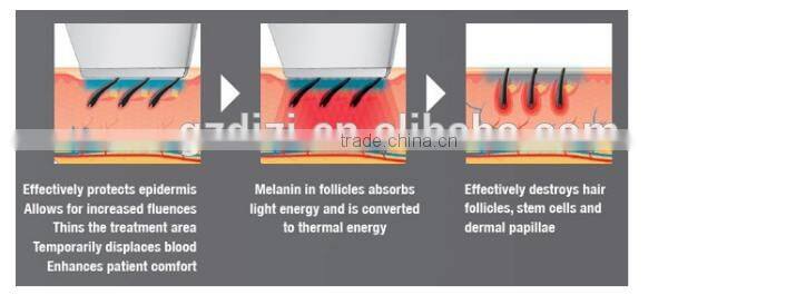 Portable OPT Shr Hair Removal Machine and skin rejuvenation machine