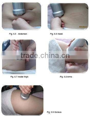 Ultrasonic Liposuction Equipment Cavitation with Vacuum