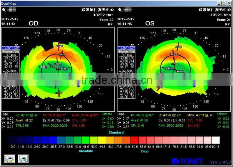 MCT Hard lens For low myopia/MCT lenses/no operation treat myopia,make your eyes normal