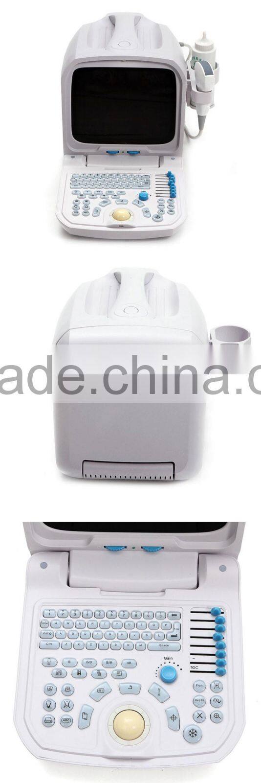 Lowe Price Medical Equipment Portable Cheap ultrasound Scanner/Machine 3.5Mhz multi-frequency Convex Probe