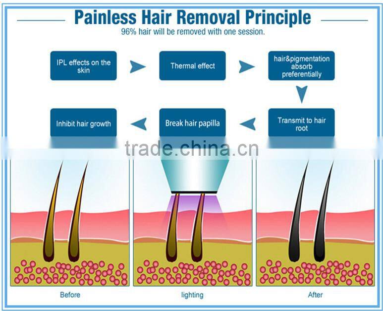 latest technology new design super hair removal machine ipl shr