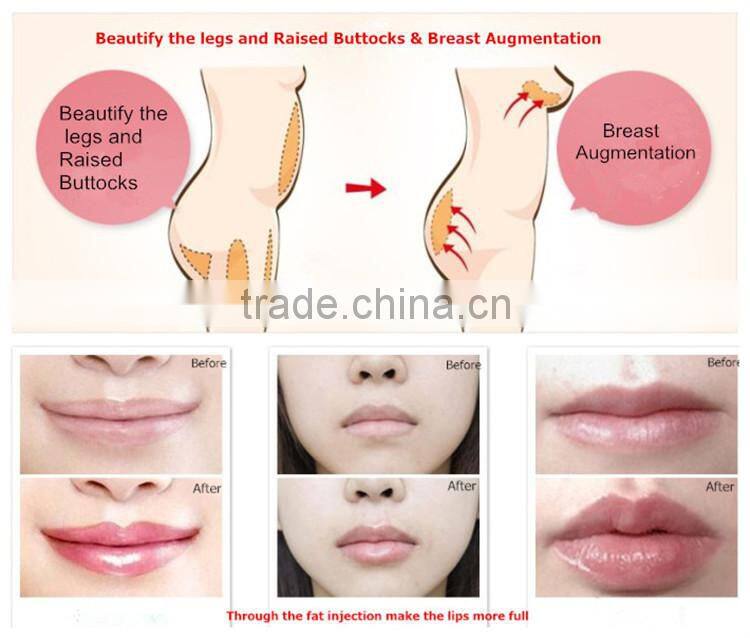 advance sealed caps syinges fat and blood plasma extract centrifuge TD4-MR