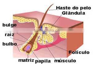 Best selling ipl photofacial machine / portable hair removal machine good effect ipl beauty machine ICE 1