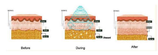 CE approved portable fat reduction machine radio frequency cavitation slimming machine