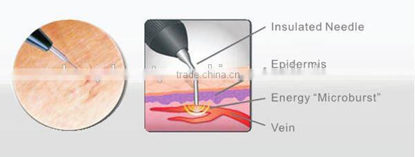 Spider vein cure beauty device laser equipment for spider veins
