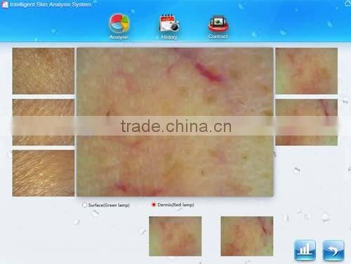 Home, salons and clinics using portable skin tightening skin analyzer