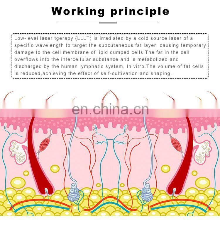 532nm Wavelengths Body slimming machine 6D Laser Non-invasive Weight Loss Shaping Beauty Instrument green laser light Device