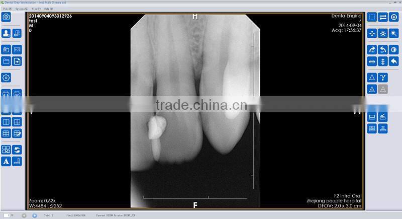 USB Digital Dental X-ray Sensor