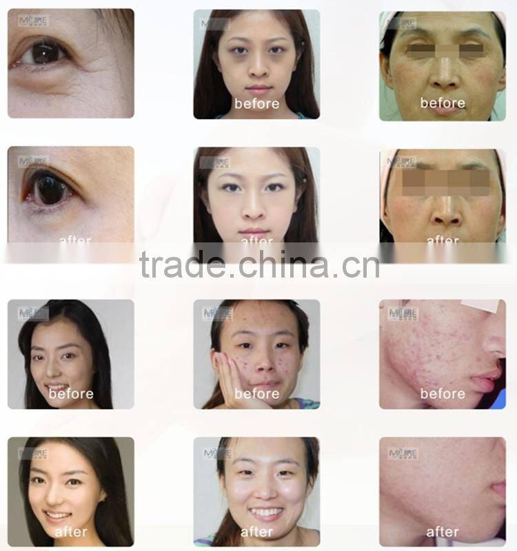 CE approval led facial rejuvenation beauty machine