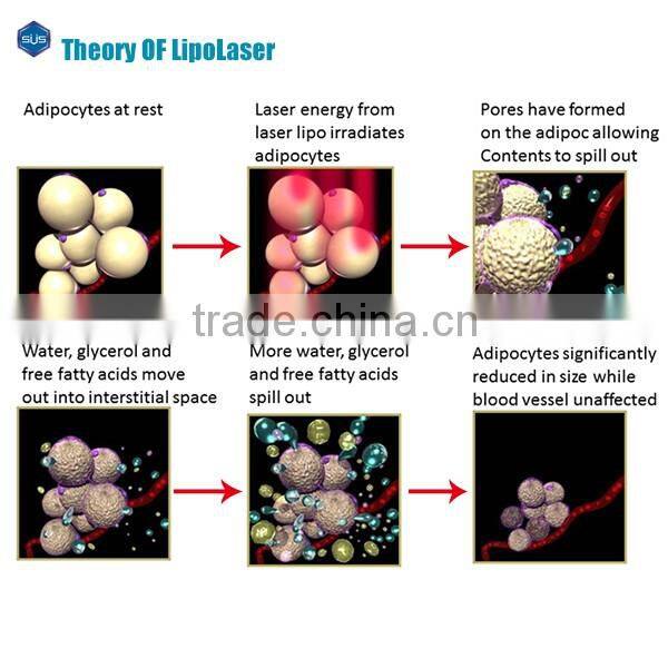 Reducing Belly Fat Ultrasound Slimming Machine Lipolaser Slimming Machine Laser Slimming Machine