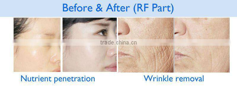 instant effect Laser+RF+IPL multifunction beauty machine with CE approved IRL20