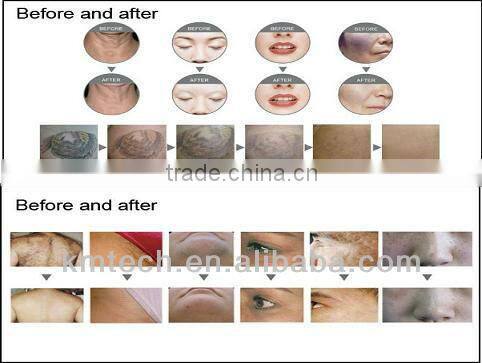Factory outlets!! versatile multifunction facial beauty machine for sale