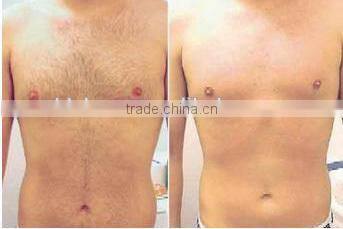 Diode Laser Skin Rejuvenation Equipment 808nm Diode Laser (808)