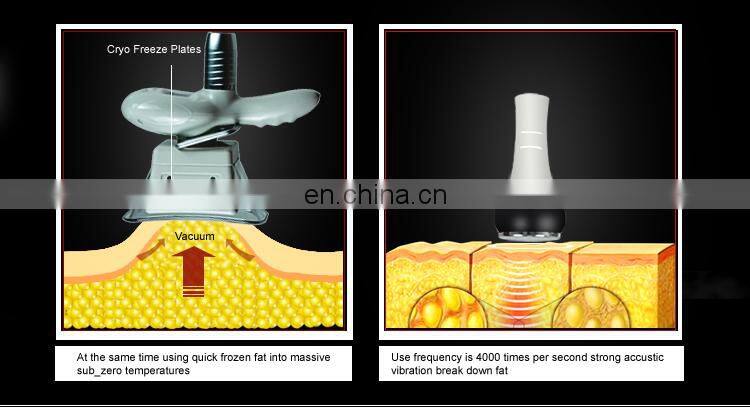Cryotherapy fat freezing machine/Slimming liposuction cryolipolysis fat freezing device