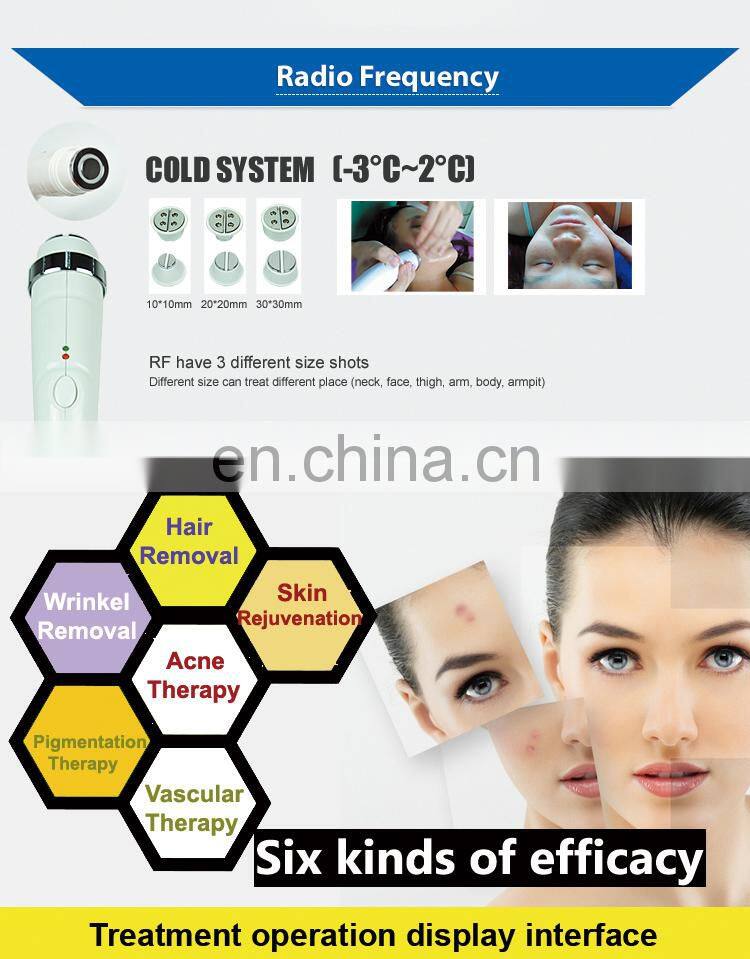 Best Selling Multifunction ipl+rf shr Hair Removal Beauty Salon Machine