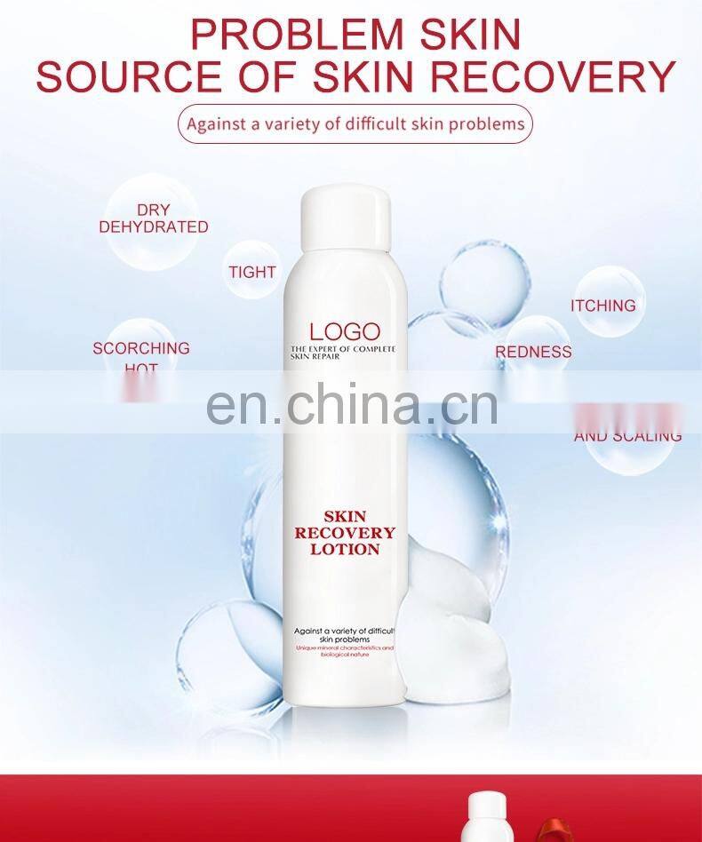 Best Beauty Organic Face Toner Moisturizing Face Peeling Toner For Face Mist Spray