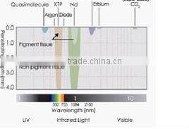 2016 best professional laser tattoo removal machine AL1