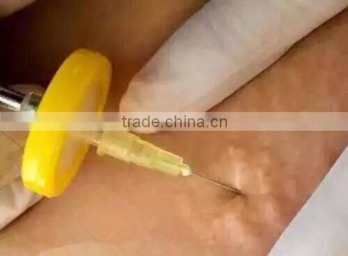 2015 hottest CDT CO2 carboxy therapy machine with free gases/needles/filters