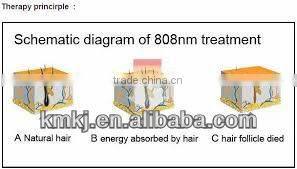 2014 New design 810nm laser diode for hair removal