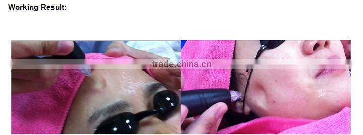 NL-HS202 2016 hot jet water cannon/oxygen jet/oxygen facial machine