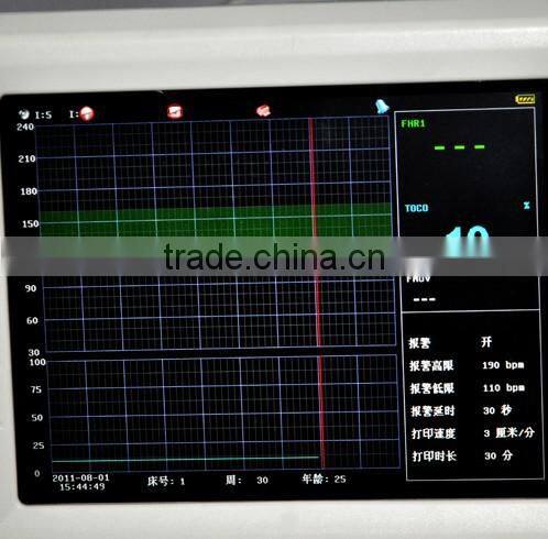 fetal heart rate monitoring Fetal monitor Single Twins Monitoring with Transducer fetal paper