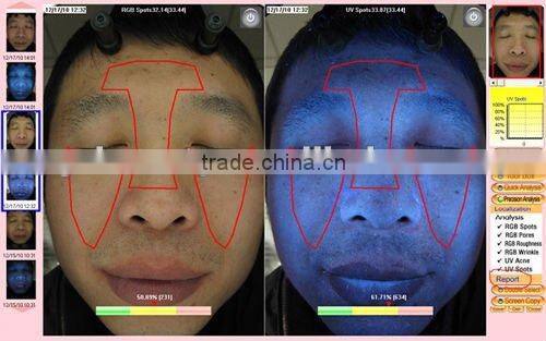 WT-01-S Portable Magic Mirror skin diagnosis system