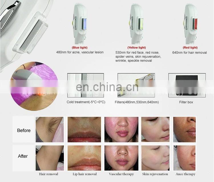4 in 1 shr e light ipl opt rf & nd yag laser & hair removal multifunctional beauty machine with best quality on alibaba