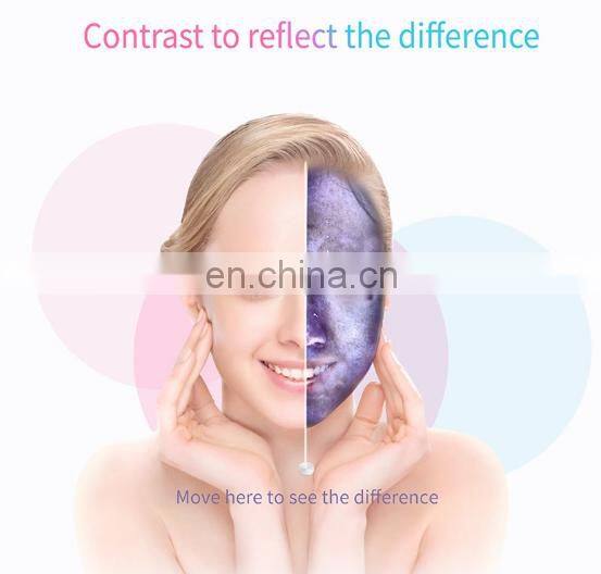 Newest Multi-languages Auto-analysis 10 Mega Pixels Beauty Skin Moisture Analyzer