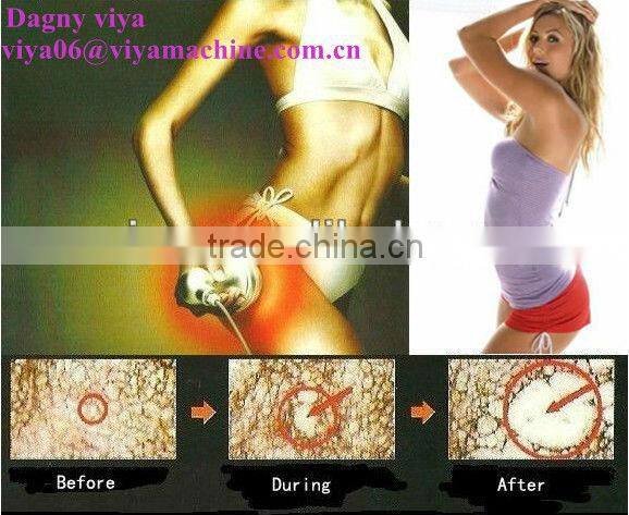 VY-Q2A Best selling products low price weight loss machine