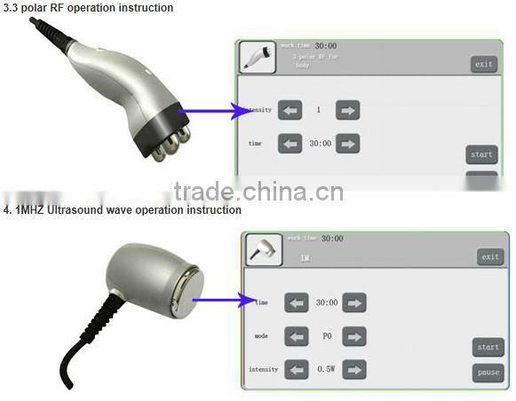 Professional 4 in 1 new 1M/40KHz ultra lipo cavitation rf equipment for slimming