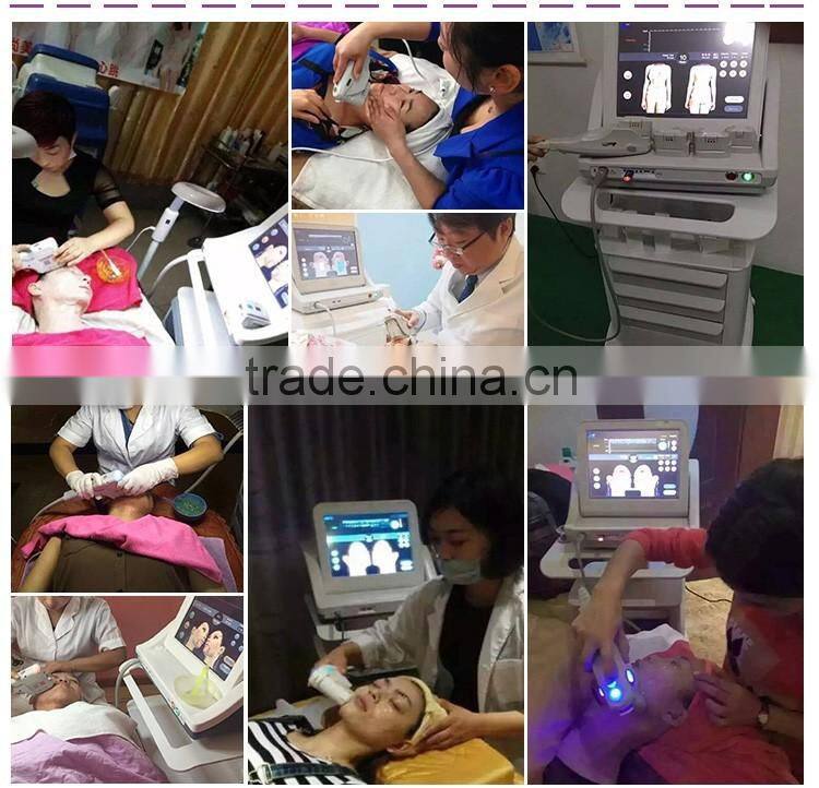 E-light ipl rf+nd yag laser multifunctional machine ipl e-light rf shr